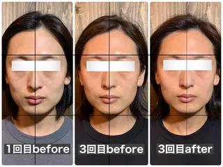 💎後悔させない小顔 矯正💎イトヤマ🌱のエステ・リラクイメージ