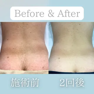 美肌脱毛&毛穴専門 Nico🐰ྀི♡のエステ・リラクイメージ