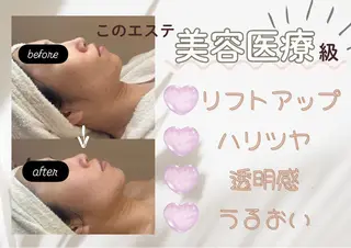 POLA THE BEAUTY 堺東店所属・肌管理🌿毛穴改善 POLA堺東のエステ・リラクイメージ