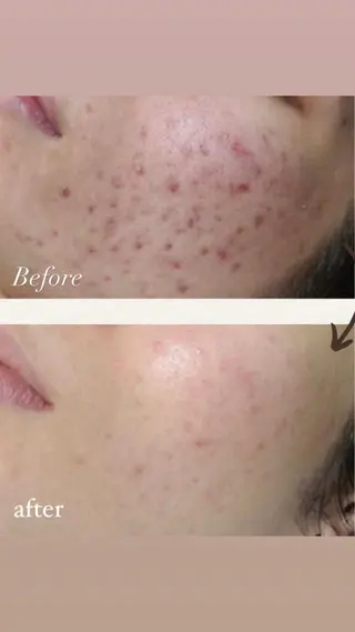 本気の肌質改善スキン デトックス🌿のエステ・リラクイメージ