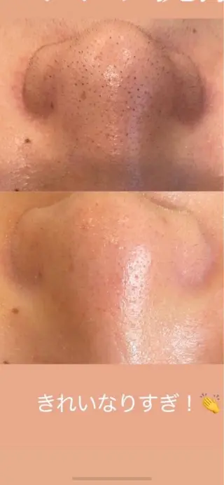 ベルーテ エッセンスのエステ・リラクイメージ