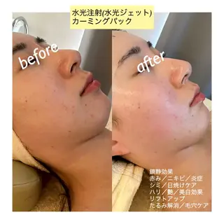 うなじ脱毛/美肌脱毛 LABELのエステ・リラクイメージ