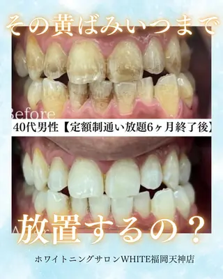 メンズ キッズ ホワイトニング専門店 WHITE天神店のエステ・リラクイメージ