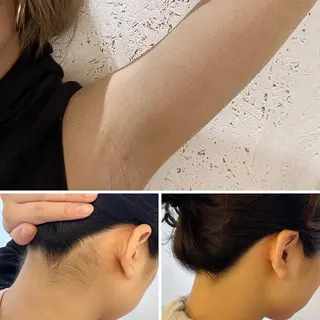うなじ脱毛/美肌脱毛 LABELのエステ・リラクイメージ