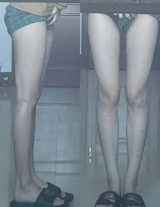 aliaハイフ&水光ジェットサロン所属・aliaハーブ水光店 エステティシャン募集のエステ・リラクイメージ