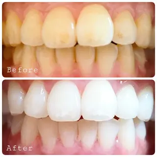 ほわいと あざぶのマツエク・マツパデザイン