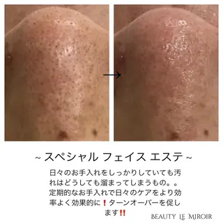 ビューティー ミロワールのエステ・リラクイメージ