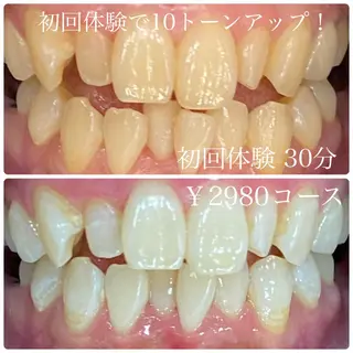 ホワイトニングルーム　川崎店所属・ホワイトニング ルーム　川崎店のその他イメージ