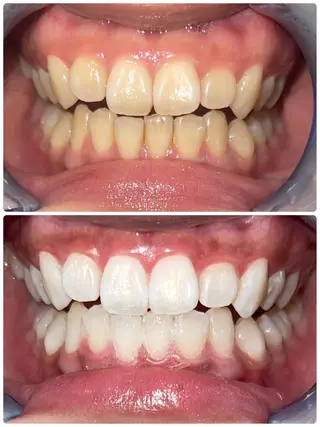 セルフホワイトニング エクシア徳島店マユのその他イメージ