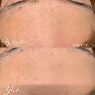 one day所属・肌質改善ハーブサロン ALA原宿のエステ・リラクイメージ