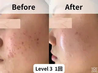 【ハーブピーリング&アロマリンパマッサージ nana】医療提携サロン所属・美肌&アロマ🌸 nana 中目黒のエステ・リラクイメージ