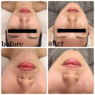 美肌脱毛・ハーブピーリング専門店Larin la beaute所属・Larin la beauteのエステ・リラクイメージ