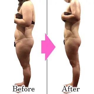 ダイエットラボ梅田店 🌟のエステ・リラクイメージ