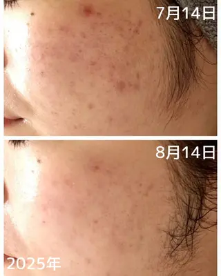 フェイシャル専門サロ ン ERINのエステ・リラクイメージ