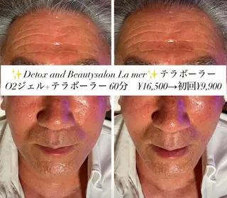 耳ツボ/体質改善/ 温活La mer月島のその他イメージ