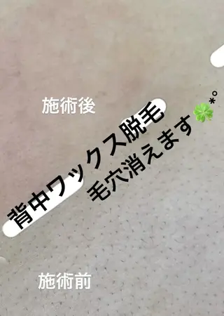 KIRAN 山﨑のエステ・リラクイメージ