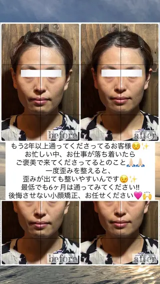 💎後悔させない小顔 矯正💎イトヤマ🌱のエステ・リラクイメージ