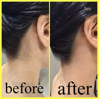 シュガーリング/脱毛 EARLS三軒茶屋のエステ・リラクイメージ