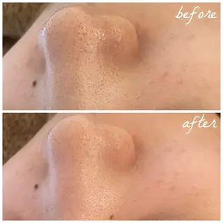 メンズ メナード岐阜市茜部 杉浦のエステ・リラクイメージ