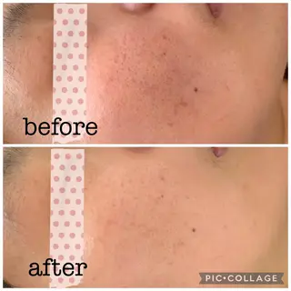 シミケア E Lashのエステ・リラクイメージ