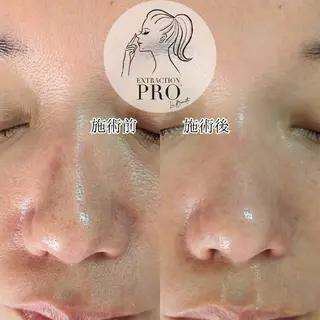  毛穴洗浄・まつ毛 の専門店 ソラーレのエステ・リラクイメージ