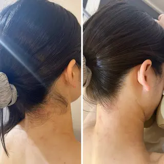 うなじ脱毛/美肌脱毛 LABELのエステ・リラクイメージ