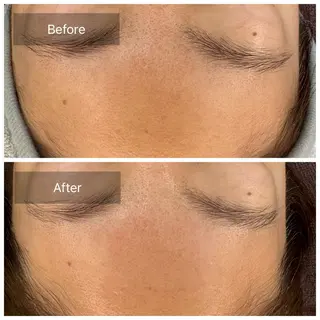 トータルしみケア専門 NICA(ニカ)のエステ・リラクイメージ