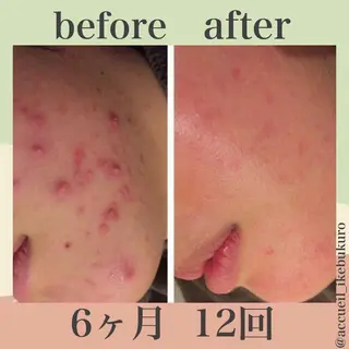 ミディアム カラー パーマ ヘアアレンジ メンズ キッズ ネイル マツエク・マツパ ニキビ・肌質改善専門 ♡人生が変わるサロンのエステ・リラクイメージ