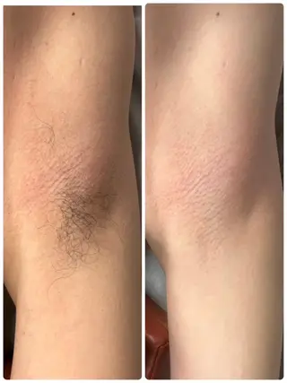 加藤 友望のエステ・リラクイメージ