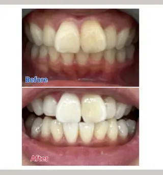 M渋谷店所属・M渋谷 ホワイトニングのエステ・リラクイメージ