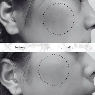 フェイシャルエステ♡ KAORIのエステ・リラクイメージ