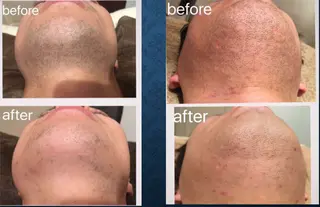 メンズ メディカルビューティーSalon Links所属・稲木 俊子のエステ・リラクイメージ