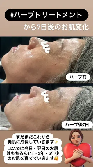 LiZA エステティックサロンのエステ・リラクイメージ