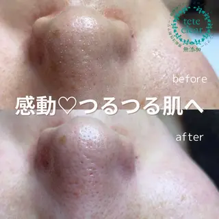 and R 男女 脱毛、毛穴サロンのエステ・リラクイメージ