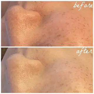 メンズ メナード岐阜市茜部 杉浦のエステ・リラクイメージ