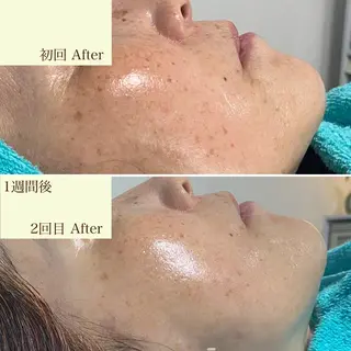 メンズ歓迎🙆‍♀️ エステ/ネイルISTのネイルデザイン