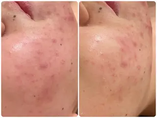 イデアルMe♡ NAKAMURAのその他イメージ