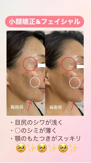 痩身・小顔・骨盤矯正×ヒップアップ専門エステ Peach所属・桃尻つかさ🍑小顔× ノーファンデ肌作りのエステ・リラクイメージ