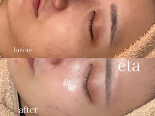 💋美ボディサロン eta【エタ】💋のエステ・リラクイメージ