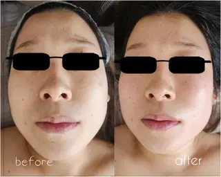 Shiny ✧︎*。のエステ・リラクイメージ