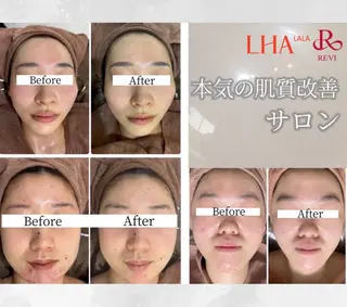 White Aqua京橋店所属・WHITE AQUAのエステ・リラクイメージ