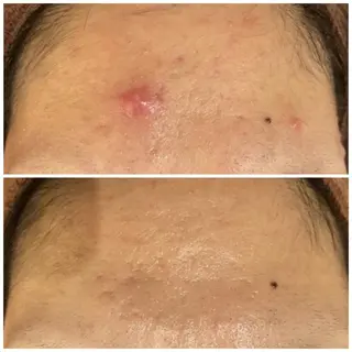 触れたくなる モテ肌へ...❤︎のエステ・リラクイメージ