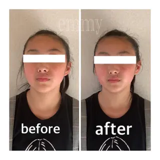 小顔と ヘッドスパのお店のエステ・リラクイメージ