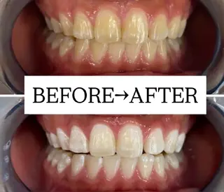 【歯科提携】歯のセルフホワイトニング専門店 セルフホワイトニングサロン宝塚所属・箕浦 乙葉のその他イメージ