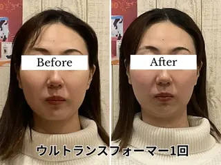 小顔矯正 natsuのエステ・リラクイメージ