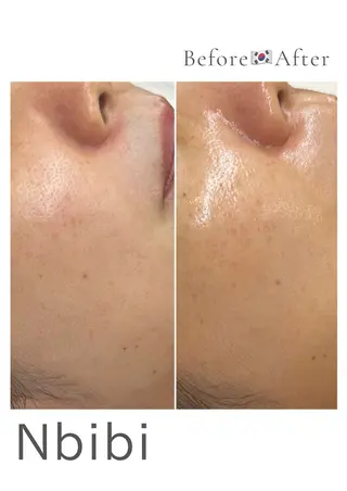 韓国🇰🇷価格 サロン_Nbibiのエステ・リラクイメージ