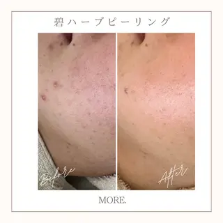 MORE. NEMAのエステ・リラクイメージ