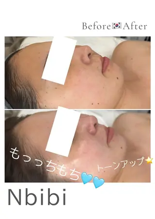 韓国🇰🇷価格 サロン_Nbibiのエステ・リラクイメージ