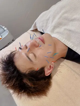 メンズ 美容鍼サロンメゾンブランシェ所属・🌸美容鍼サロン🌸 メゾンブランシェ🌈のエステ・リラクイメージ