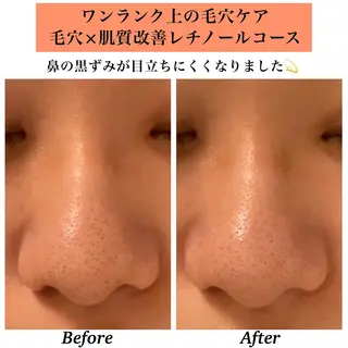 Bellesthe （ベルエステ）のエステ・リラクイメージ